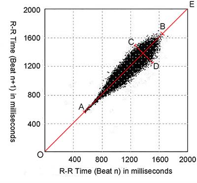 Poincaré Plot Is Useful for Distinguishing Vasovagal Syncope From Postural Tachycardia Syndrome in Children